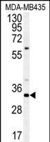 SGF29  (C-term)