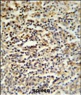 Rabbit Polyclonal Antibody to SGF29  (C-term)