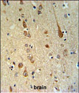 Rabbit Polyclonal Antibody to FAAH2