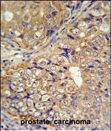 Rabbit Polyclonal Antibody to KLHL9