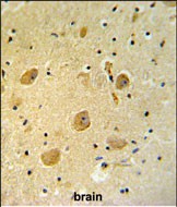 Rabbit Polyclonal Antibody to PARP16