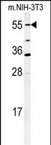 CYP26A1