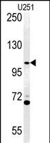 ACAP3  (N-term)
