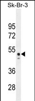 CNO6L