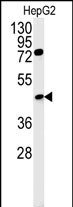 CT054