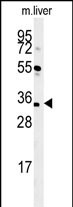 CU056