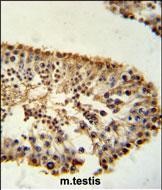 Rabbit Polyclonal Antibody to ERO1LB