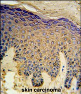 Rabbit Polyclonal Antibody to HAUS4