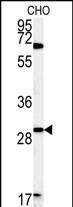 LHPL2