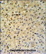 Rabbit Polyclonal Antibody to PSME1
