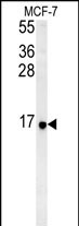 RPS26 (N-term)