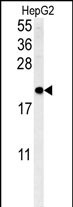SFT2D3 (N-term)