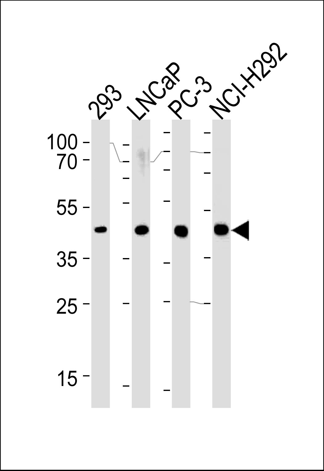 SRD5A3