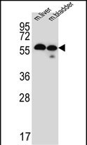 TMEM87B