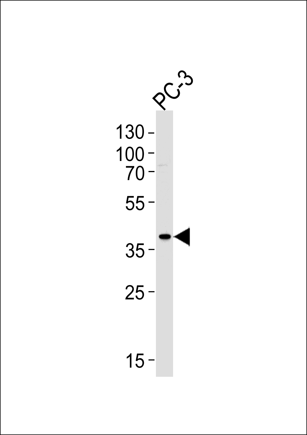 TMM79  (C-term)
