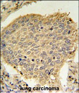 Rabbit Polyclonal Antibody to TPC6A (N-term)