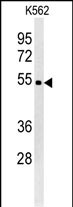 WDR73 (N-term)