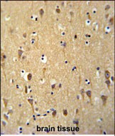 Rabbit Polyclonal Antibody to WDR73 (N-term)