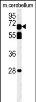 TBKB1  (N-term)
