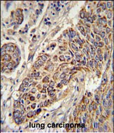 Rabbit Polyclonal Antibody to CYC1