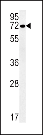 SLC19A3