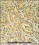 Rabbit Polyclonal Antibody to UBAC1