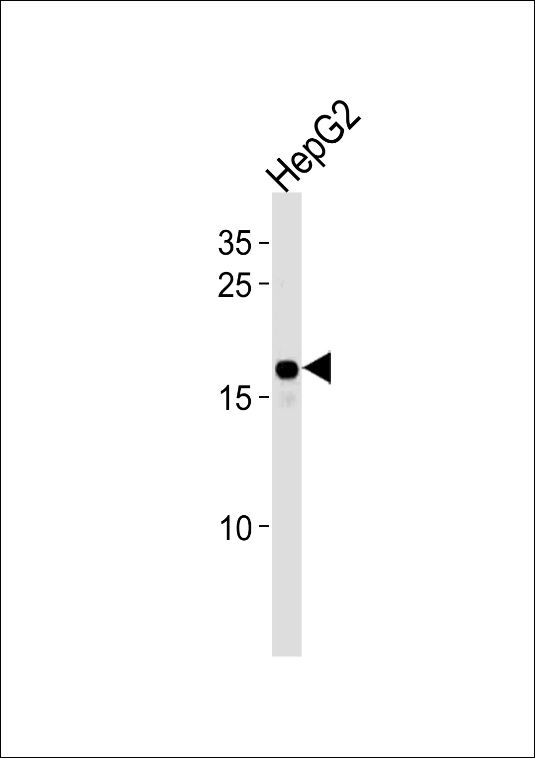 HMGA2