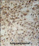 Rabbit Polyclonal Antibody to C14orf179