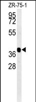 NIPAL2 (N-term)