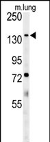 ATP11C