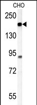 Rabbit Polyclonal Antibody to ATP11C