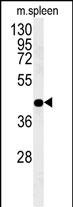 Rabbit Polyclonal Antibody to PGD