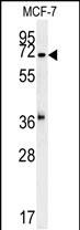 C7orf28A
