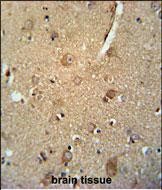 Rabbit Polyclonal Antibody to C7orf28A