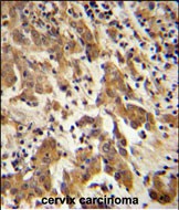 Rabbit Polyclonal Antibody to GKAP1