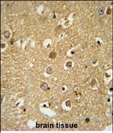 Rabbit Polyclonal Antibody to RAB11FIP2