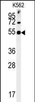 SYT13 (N-term)