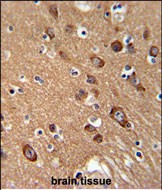 Rabbit Polyclonal Antibody to SYT13 (N-term)