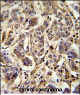 Rabbit Polyclonal Antibody to FLJ11506