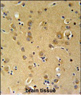 Rabbit Polyclonal Antibody to KLH20