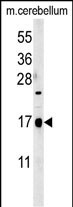 CA095  (C-term)