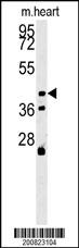 Mouse Monoclonal Antibody to ALDH3A2