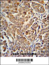Mouse Monoclonal Antibody to ALDH3A2