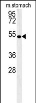 CORO6