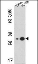 RPS3A