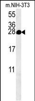 Rabbit Polyclonal Antibody to KCT2