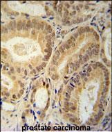 Rabbit Polyclonal Antibody to RBM24  (N-term)