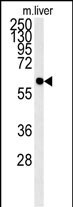 PCYXL  (C-term)