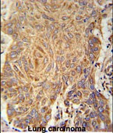 Rabbit Polyclonal Antibody to PCYXL  (C-term)