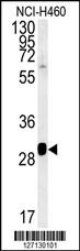 SC31B  (C-term)